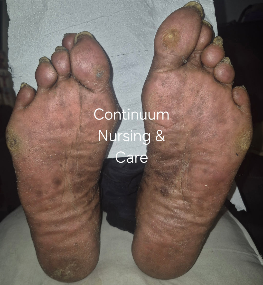 Advanced Footcare
