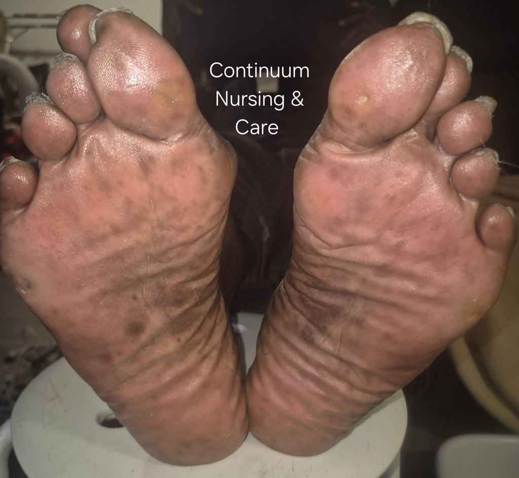 Advanced Footcare