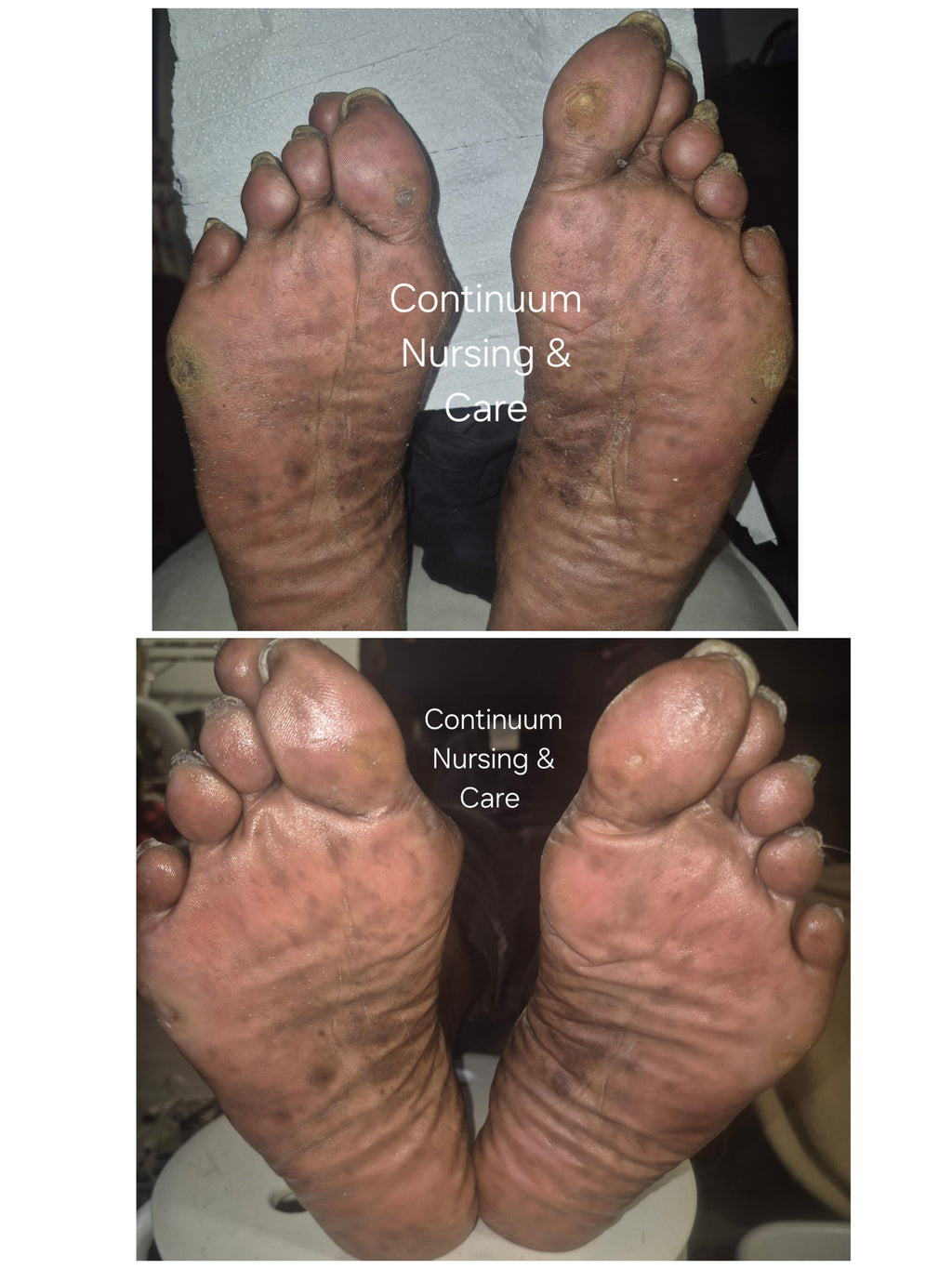 Advanced Footcare